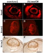 PITX3 Antibody in Immunohistochemistry (IHC)