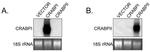 CRABP1 Antibody in Western Blot (WB)