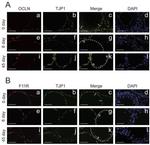 JAM-A (CD321) Antibody in Immunohistochemistry (IHC)