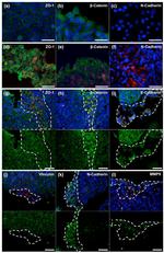 beta Catenin Antibody in Immunocytochemistry (ICC/IF)