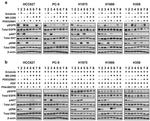 Phospho-EGFR (Tyr1068) Antibody in Western Blot (WB)