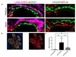 CD31 Antibody in Immunohistochemistry (IHC)