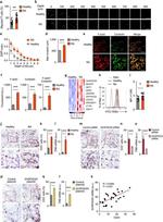 Cortactin Antibody in Immunocytochemistry (ICC/IF)