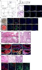 AGR2 Antibody in Immunohistochemistry (IHC)