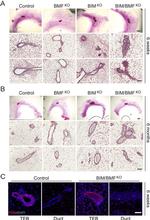 PCNA Antibody in Immunohistochemistry (IHC)