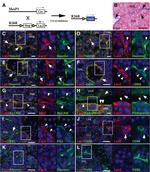 Podoplanin Antibody in Immunohistochemistry (IHC)