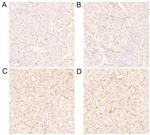 CD34 Antibody in Immunohistochemistry (IHC)