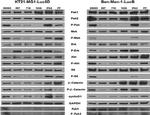 Phospho-PAK1/2/3 (Ser141) Antibody in Western Blot (WB)