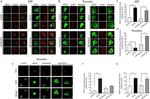 Endostatin Antibody in Immunocytochemistry (ICC/IF)