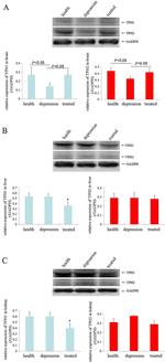 TPH1 Antibody in Western Blot (WB)