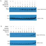 PARP1 (cleaved Asp214, Asp215) Antibody in Western Blot (WB)