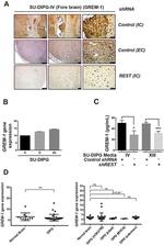 GREM1 Antibody in Immunohistochemistry (IHC)