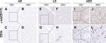 c-Kit Antibody in Immunohistochemistry (IHC)