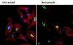 Phospho-CHK2 (Thr68) Antibody in Immunocytochemistry (ICC/IF)