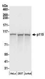 p115 Antibody in Western Blot (WB)