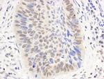 p300 Antibody in Immunohistochemistry (IHC)