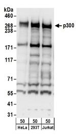 p300 Antibody in Western Blot (WB)