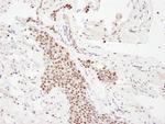 p300 Antibody in Immunohistochemistry (IHC)