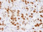 p300 Antibody in Immunohistochemistry (IHC)