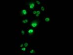 p53 Antibody in Immunocytochemistry (ICC/IF)