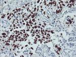 p53 Antibody in Immunohistochemistry (Paraffin) (IHC (P))