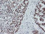 p53 Antibody in Immunohistochemistry (Paraffin) (IHC (P))