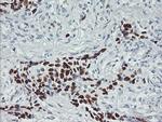 p53 Antibody in Immunohistochemistry (Paraffin) (IHC (P))