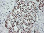 p53 Antibody in Immunohistochemistry (Paraffin) (IHC (P))