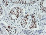 p53 Antibody in Immunohistochemistry (Paraffin) (IHC (P))