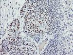 p53 Antibody in Immunohistochemistry (Paraffin) (IHC (P))