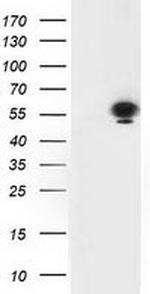 p53 Antibody in Western Blot (WB)