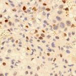 p57 Kip2 Antibody in Immunohistochemistry (Paraffin) (IHC (P))