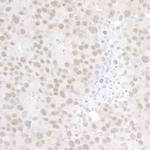 p66alpha Antibody in Immunohistochemistry (IHC)