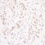 p66beta/GATAD2B Antibody in Immunohistochemistry (IHC)