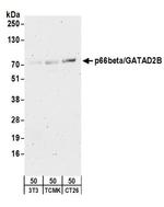 p66beta/GATAD2B Antibody in Western Blot (WB)