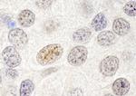 p66beta/GATAD2B Antibody in Immunohistochemistry (IHC)