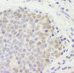 p66beta/GATAD2B Antibody in Immunohistochemistry (IHC)