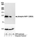 Phospho-KAP-1 (Ser824) Antibody in Western Blot (WB)