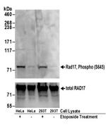 Phospho-Rad17 (Ser645) Antibody in Western Blot (WB)