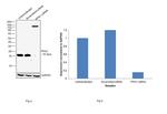 Profilin 1 Antibody in Western Blot (WB)