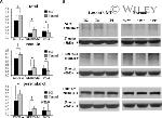 SERCA2 ATPase Antibody in Western Blot (WB)