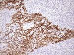 pan Cytokeratin (pan CK) Antibody in Immunohistochemistry (Paraffin) (IHC (P))