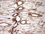 pan Cytokeratin (pan CK) Antibody in Immunohistochemistry (Paraffin) (IHC (P))