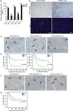 INSR beta Antibody in Immunohistochemistry (Paraffin) (IHC (P))