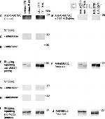 O-linked N-acetylglucosamine (O-GlcNAc) Antibody in Western Blot (WB)