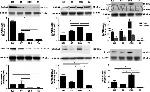 SERCA1 ATPase Antibody in Western Blot (WB)