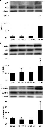 Phospho-IR/IGF1R (Tyr1158, Tyr1162, Tyr1163) Antibody in Western Blot (WB)