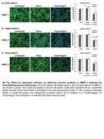 beta Catenin Antibody in Immunocytochemistry (ICC/IF)