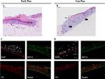 Involucrin Antibody in Immunohistochemistry (IHC)