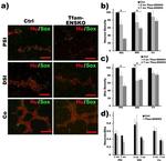 HuC/HuD Antibody in Immunohistochemistry (IHC)